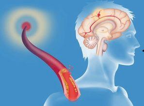脑梗病人可以吃狼瓜吗米,狼瓜的适宜性探讨