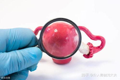 子宫肌瘤吃蜜瓜,天然食疗新选择